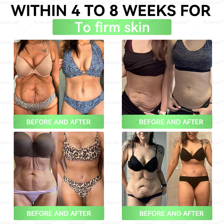 BuildLeaf® Only 5 boxes left! ⏰🎉We're offering you an additional 30% discount! Get yourself in shape and healthy. Miss out now, and you won't have another chance until next year.