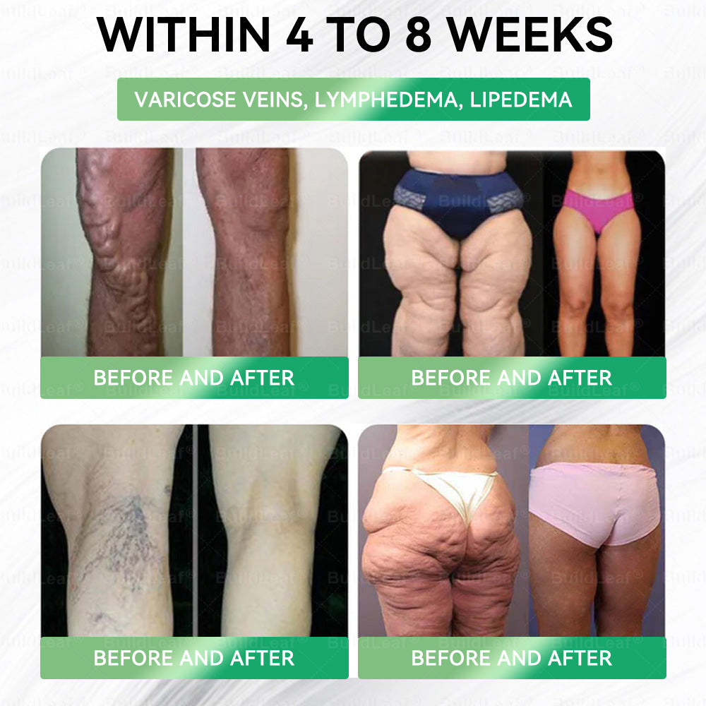 BuildLeaf® Only 5 boxes left! ⏰🎉We're offering you an additional 30% discount! Get yourself in shape and healthy. Miss out now, and you won't have another chance until next year.